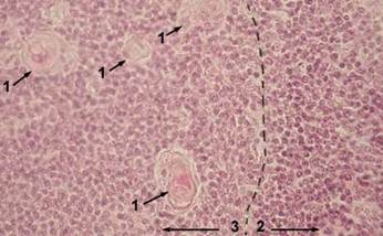 : thymus-hb-01-l